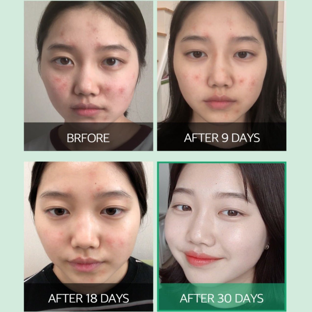 AHA.BHA.PHA 30 Days Miracle Serum | Seuro anti acne 50ml - Koelleza Store
