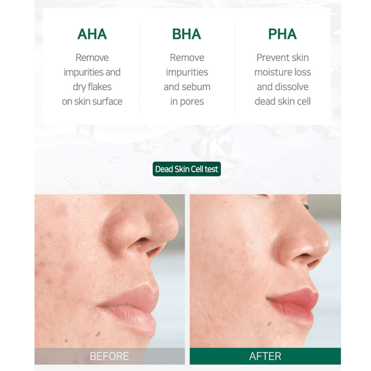 AHA.BHA.PHA 30 Days Miracle Starter Kit | Rutina anti acne - Koelleza Store