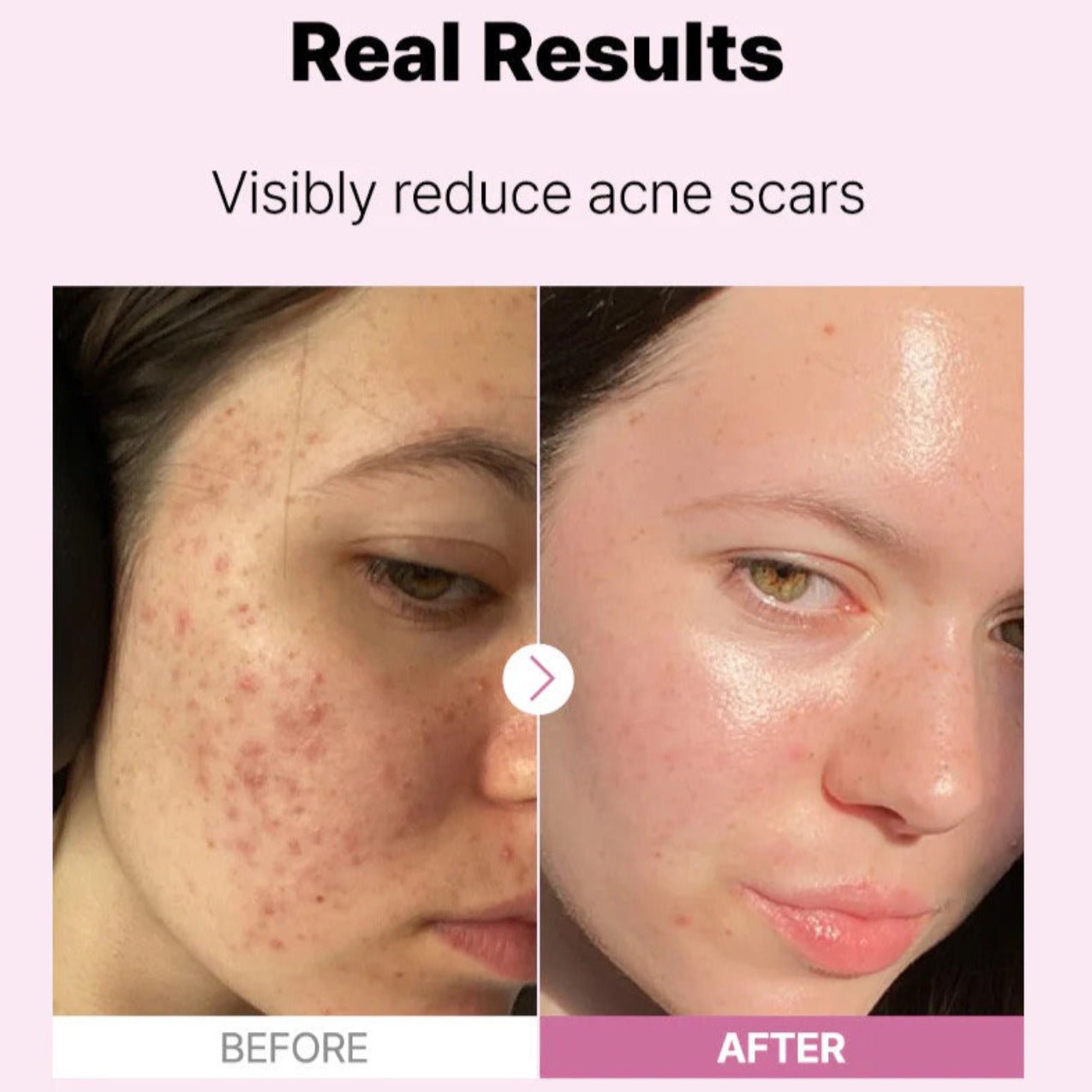 The Niacinamide 15 Serum (suero Niacinamida) | Koelleza Store