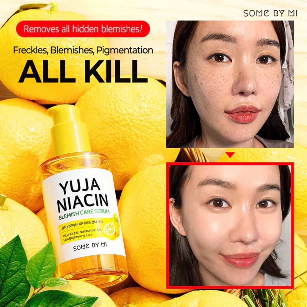Yuja Niacin 30 Days Blemish Care Serum 50ml | Suero blanqueador - Koelleza Store